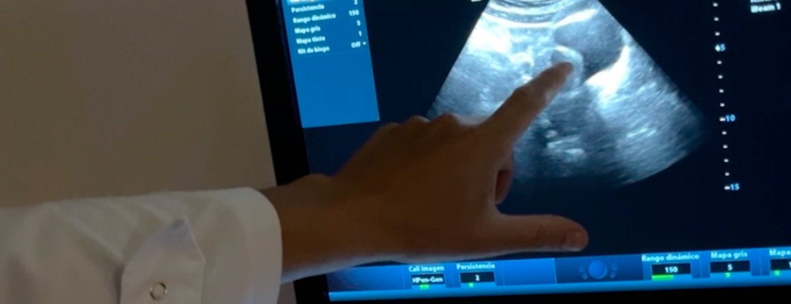 Ecografía abdominal completa: cómo prepararte y por qué es clave el ayuno
